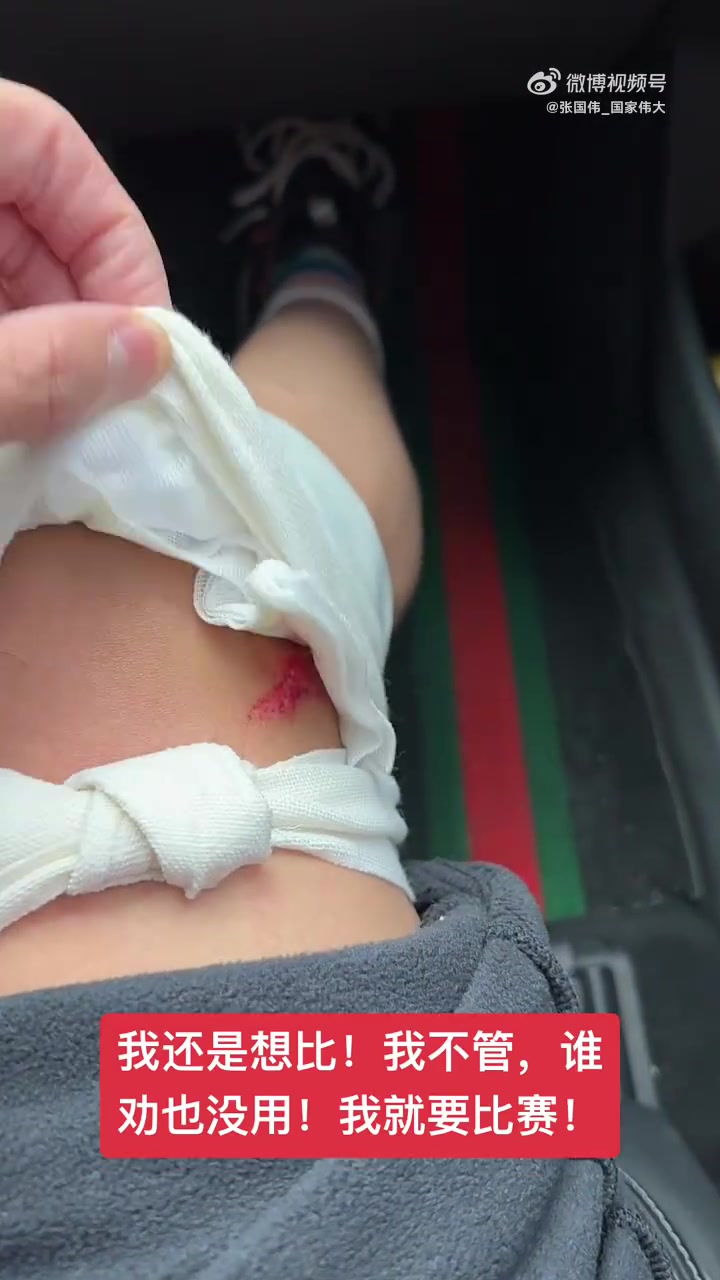mksports体育张国伟晒受伤视频：我不管，我就要现在比赛，死也死在比赛场上